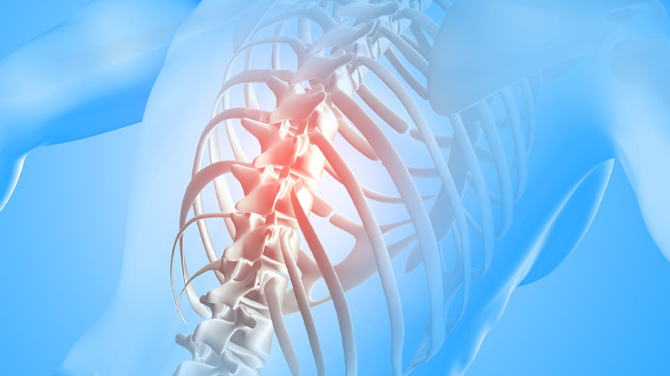 ¿Qué es el Bloqueo Paravertebral e importancia para el paciente?