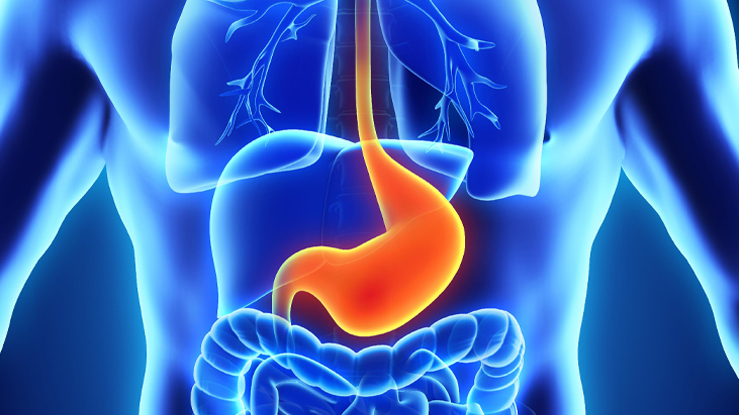 Causas y tipos de gastritis: Todo lo que necesitas saber para cuidar tu salud
