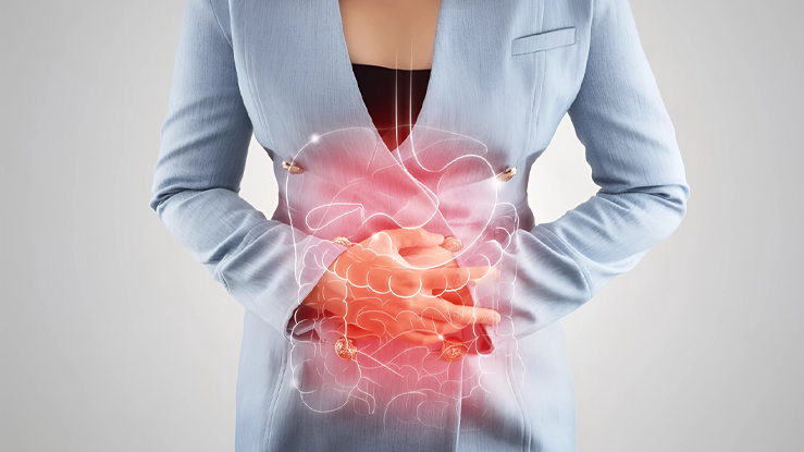 Colon irritable: Cómo manejar los síntomas y mejorar la calidad de vida